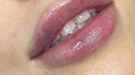 Close-up of glossy, hydrated lips at Shak Smith Aesthetics in Bridgetown, Saint Michael, BB.