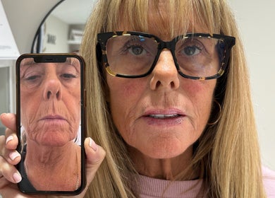 Woman at Shak Smith Aesthetics using mobile skin analysis in Bridgetown, Saint Michael, BB.