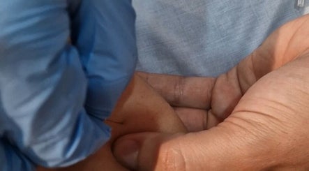 Masajista aplicando acupuntura en Masaje a domicilio Barcelona - John Fuentes, Barcelona, Catalunya, ES.