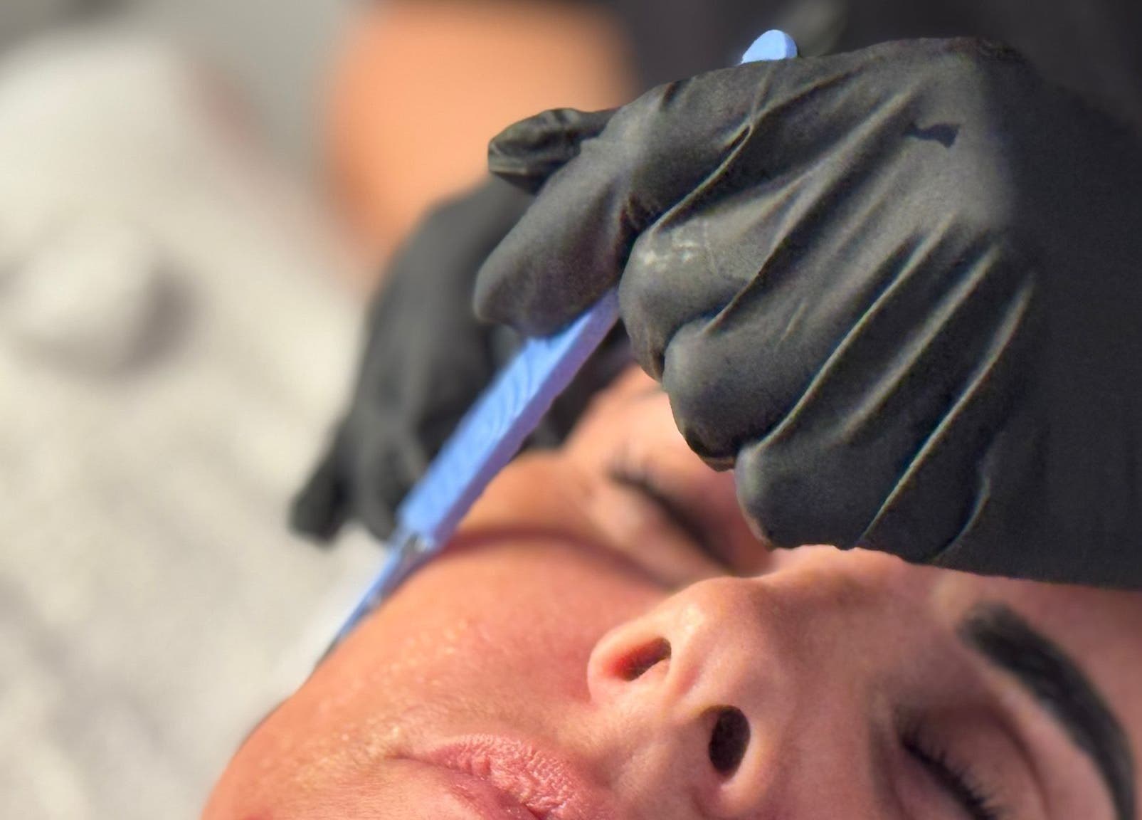 Professional dermaplaning treatment at Sal King Aesthetics, St. Neots, England, GB.