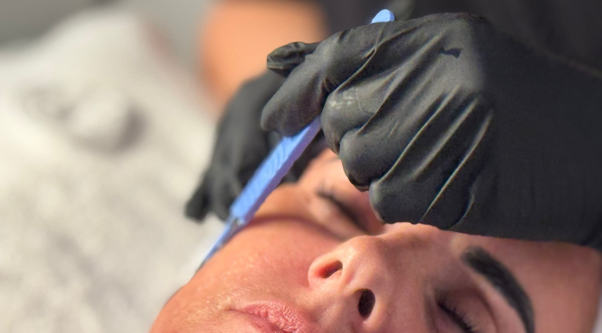 Professional dermaplaning treatment at Sal King Aesthetics, St. Neots, England, GB.