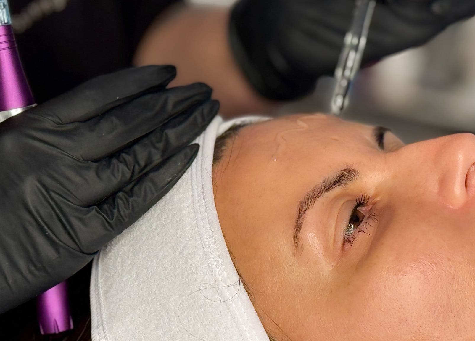 Facial treatment at Sal King Aesthetics, St. Neots, England, GB, showcasing detailed skincare process.