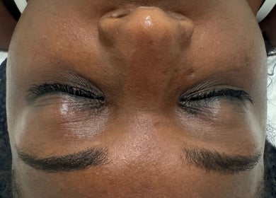 Close-up of relaxed brows after treatment at Fran Bonfim Aesthetics, Margate, Florida, US.