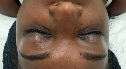 Close-up of relaxed brows after treatment at Fran Bonfim Aesthetics, Margate, Florida, US.
