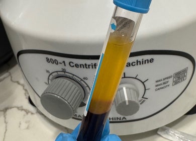 Centrifuge machine at Fran Bonfim Aesthetics, Margate, Florida, US showcasing a test tube procedure.