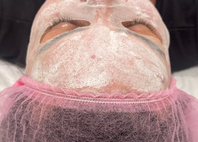 Facial treatment at Fran Bonfim Aesthetics in Margate, Florida, US, highlighting skincare expertise.