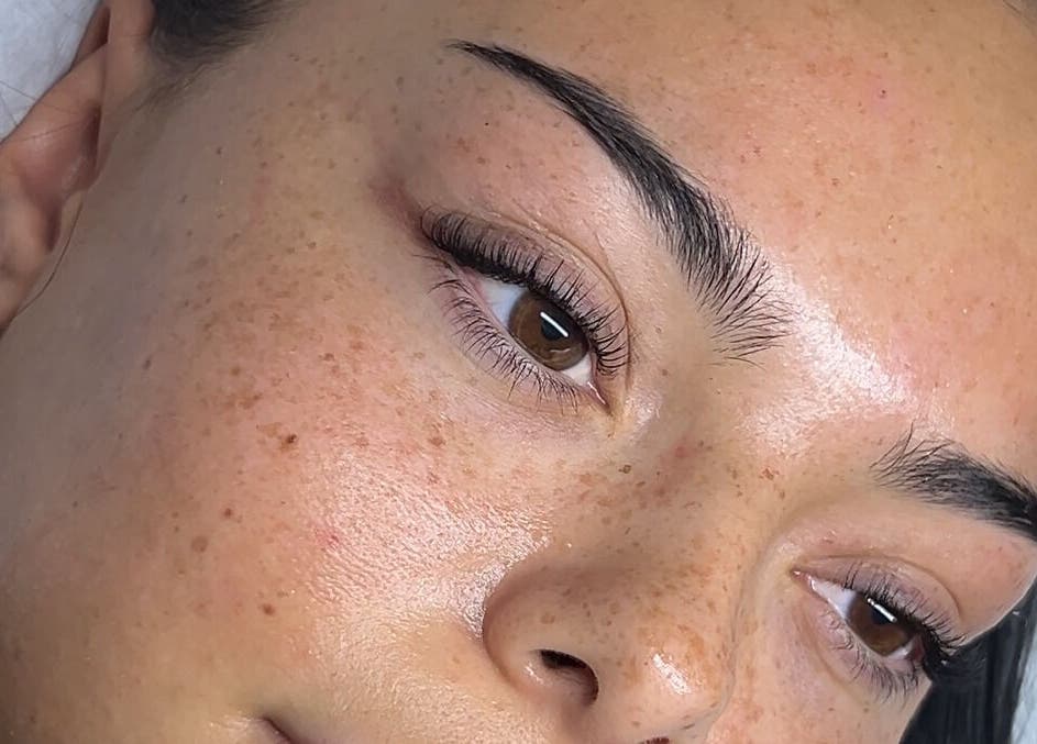 Close-up of glowing skin after facial treatment at By Ella Chiara, London, England, GB.