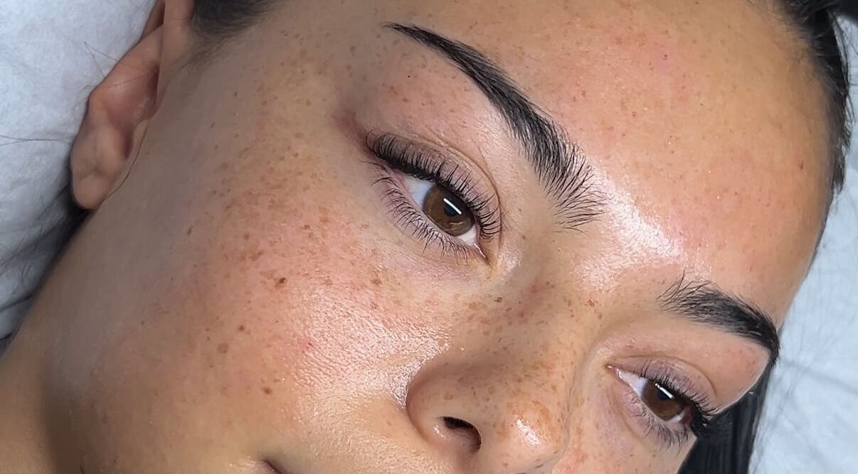 Close-up of glowing skin after facial treatment at By Ella Chiara, London, England, GB.