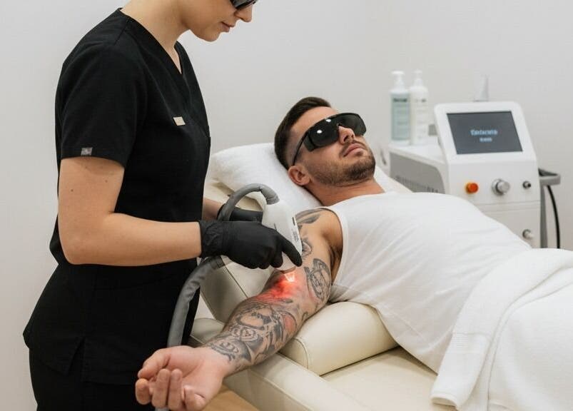 Professional laser tattoo removal at The Groom Room in George, Western Cape, ZA.