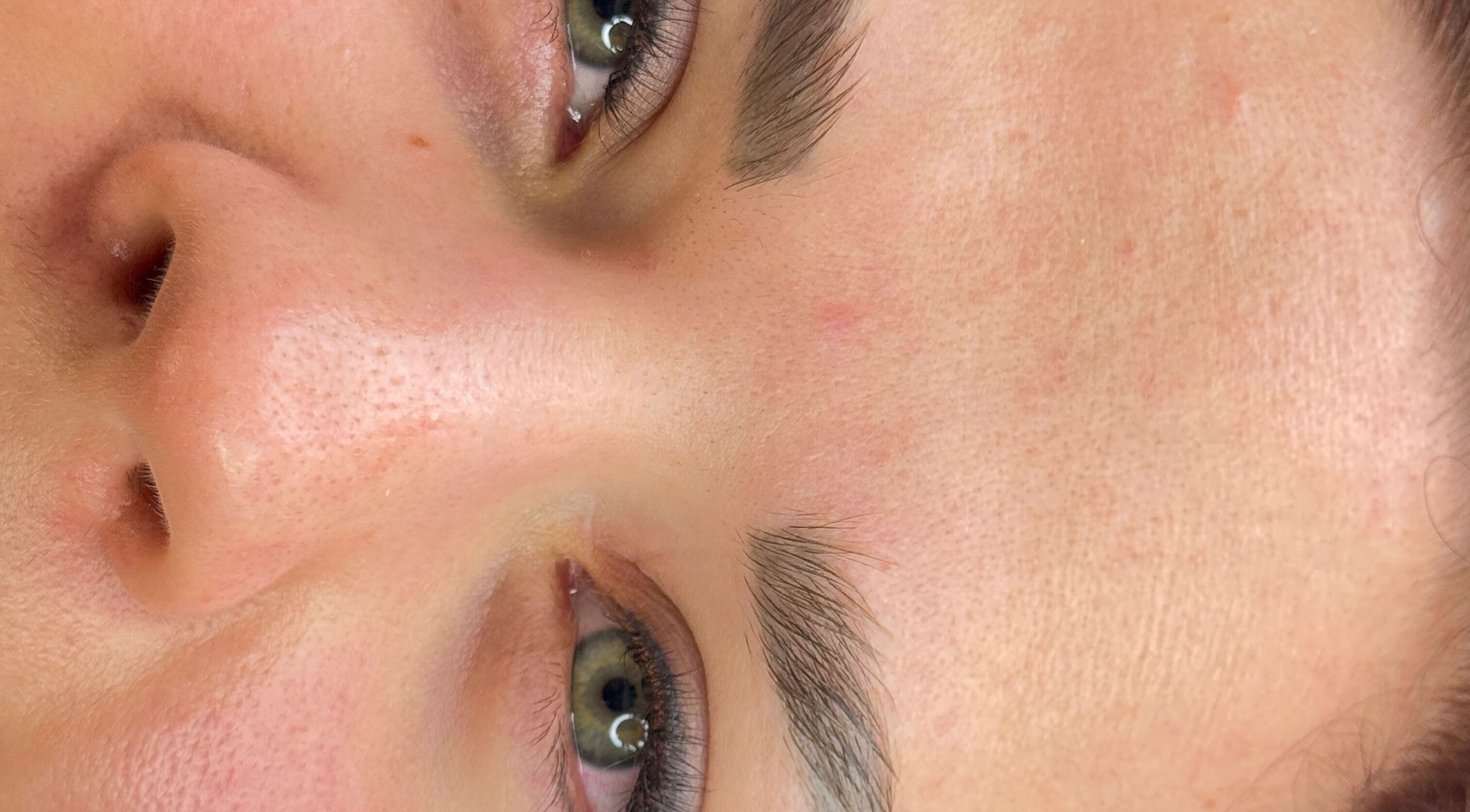 ผิวหน้าสวยใส ชัพธอสที่ Channy Beauty Studio, Hohentengen Am Hochrhein, Baden-württemberg, DE