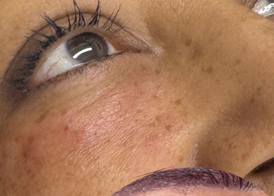 Close-up of a client's eye showcasing skin detail at MavenAesthetics, London, England, GB.