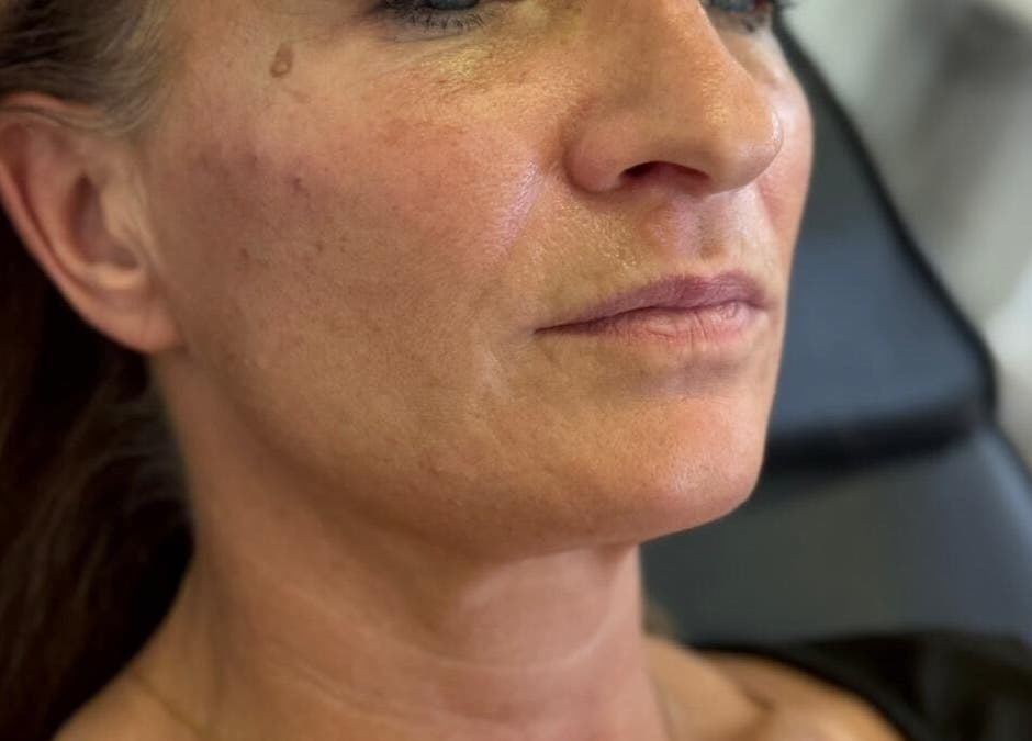 Close-up of woman receiving skincare treatment at Laser & Skin Belfast, Belfast, Northern Ireland, GB.