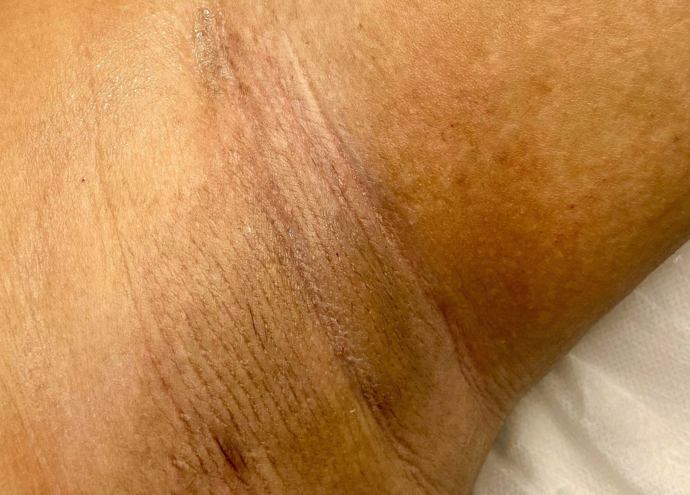 Surface de la peau à Casa Bella Mar, Toulouse, Occitanie, FR pour rajeunissement cutané.