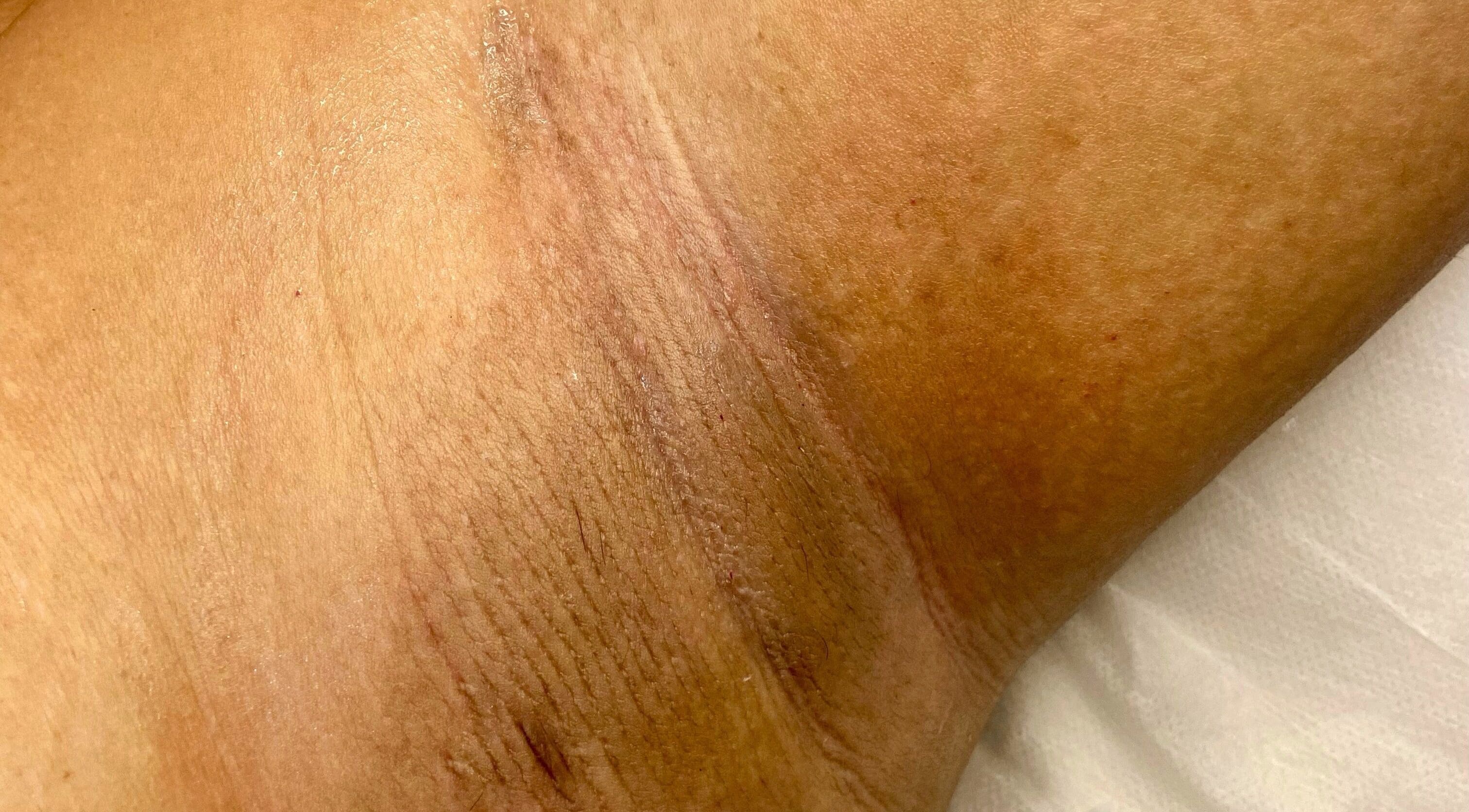 Surface de la peau à Casa Bella Mar, Toulouse, Occitanie, FR pour rajeunissement cutané.