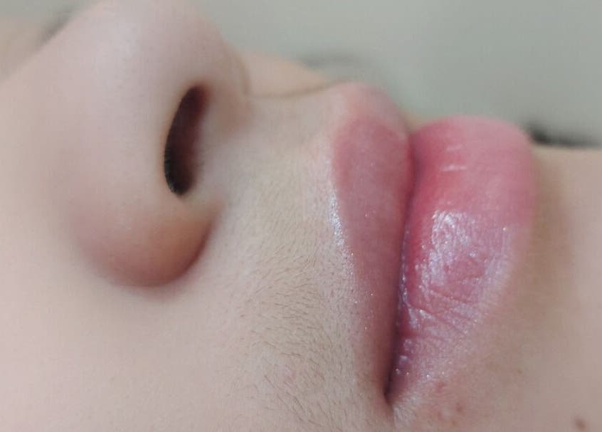 Lábios hidratados no Flowers Studio em São Paulo, São Paulo, BR, mostrando tratamento estético.