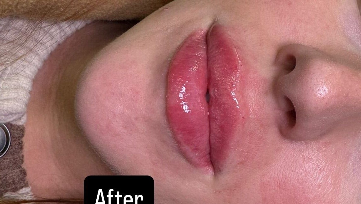 Close-up of enhanced lips at Cecilianahair, a beauty venue in Manchester, England, GB.