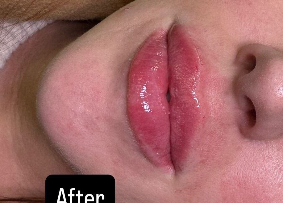 Close-up of enhanced lips at Cecilianahair, a beauty venue in Manchester, England, GB.