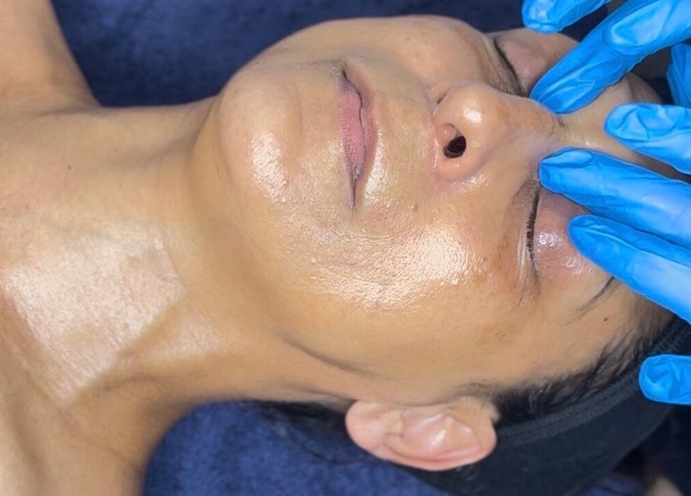 Facial treatment at Skincare & Aesthetics Clinic, Pretoria, Gauteng, ZA. Smooth, glowing skin with expert care.