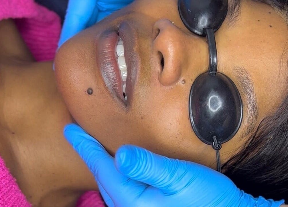 Facial treatment at Skincare & Aesthetics Clinic in Pretoria, Gauteng, ZA, highlighting relaxation and rejuvenation.