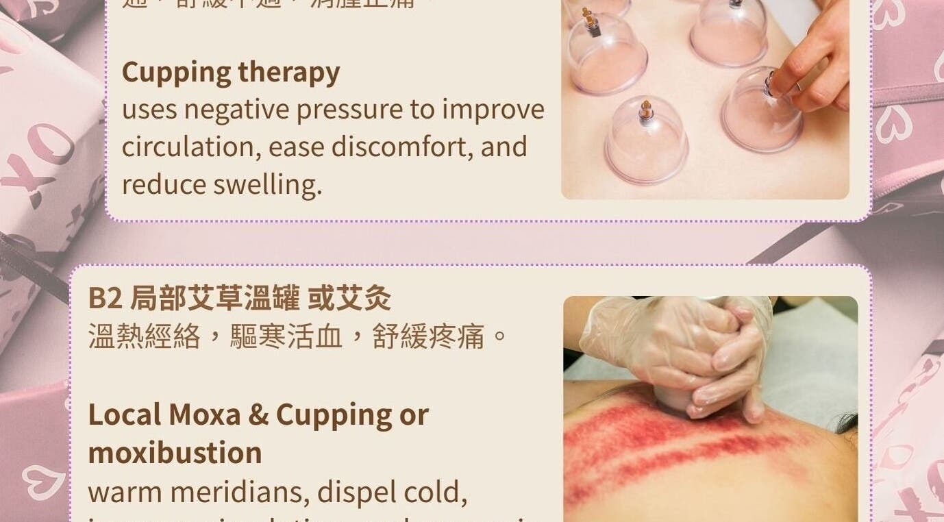 Cupping therapy at Harmony River Studio, Auckland, NZ, promoting circulation and reducing swelling.