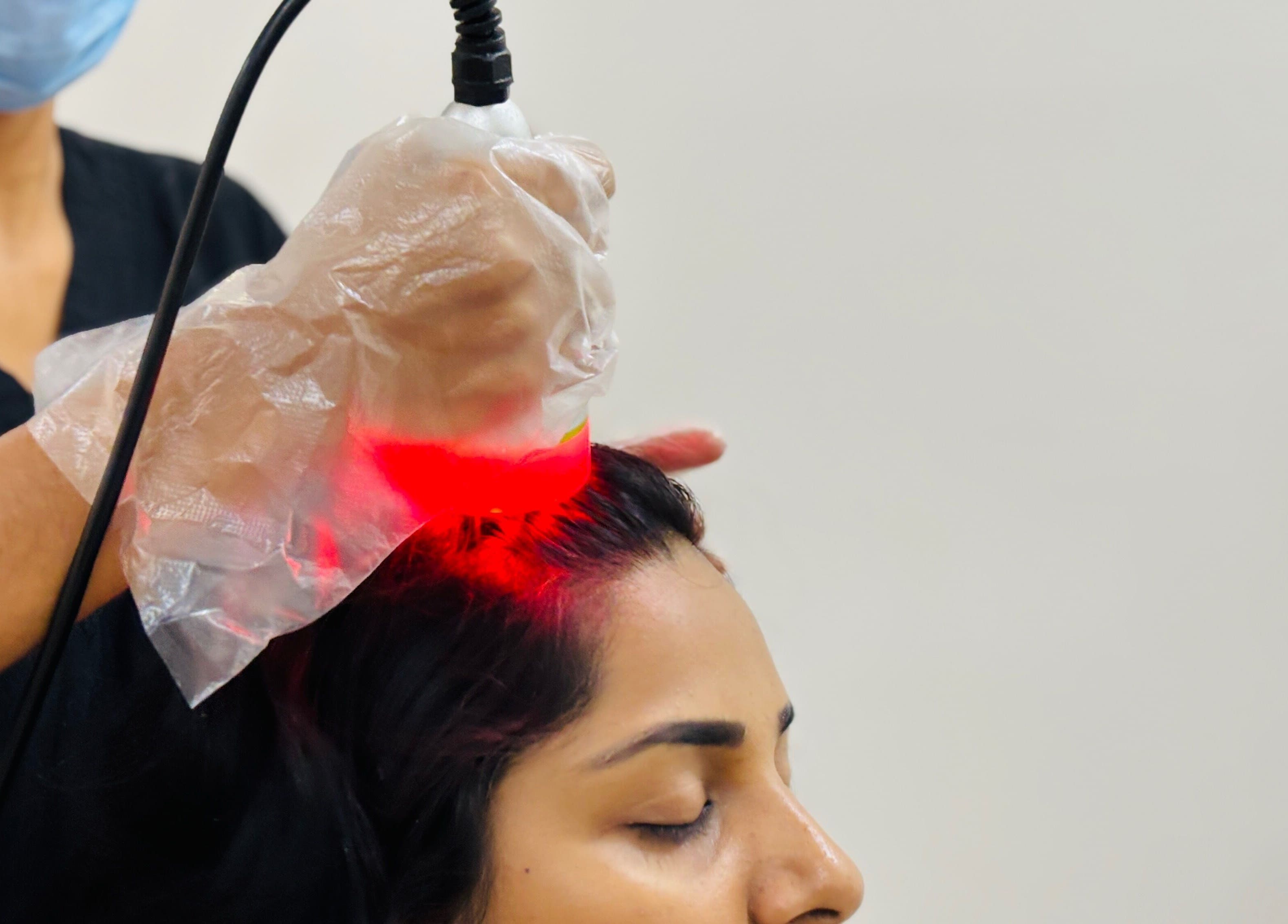 Laser therapy treatment at Dr.Akhilas Aesthetics, Hyderabad, Telangana, IN, enhancing scalp health.