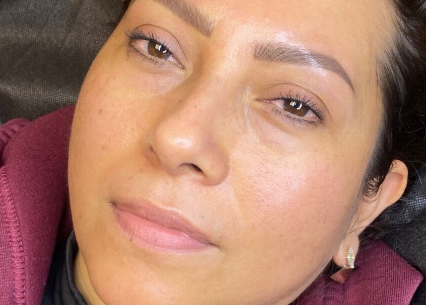 Close-up of a client's refreshed face post-treatment at Lorilane’s Cosmetics, Westlake Village, California, US.