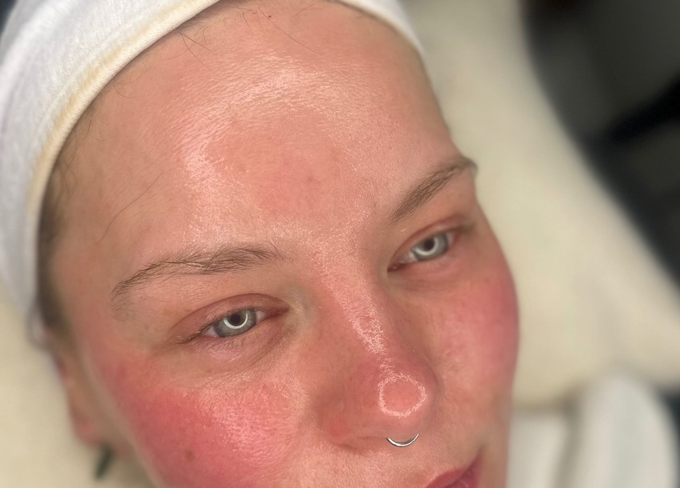 Glowing complexion after treatment at Face, Lash & Brow in Glasgow, Scotland, GB.