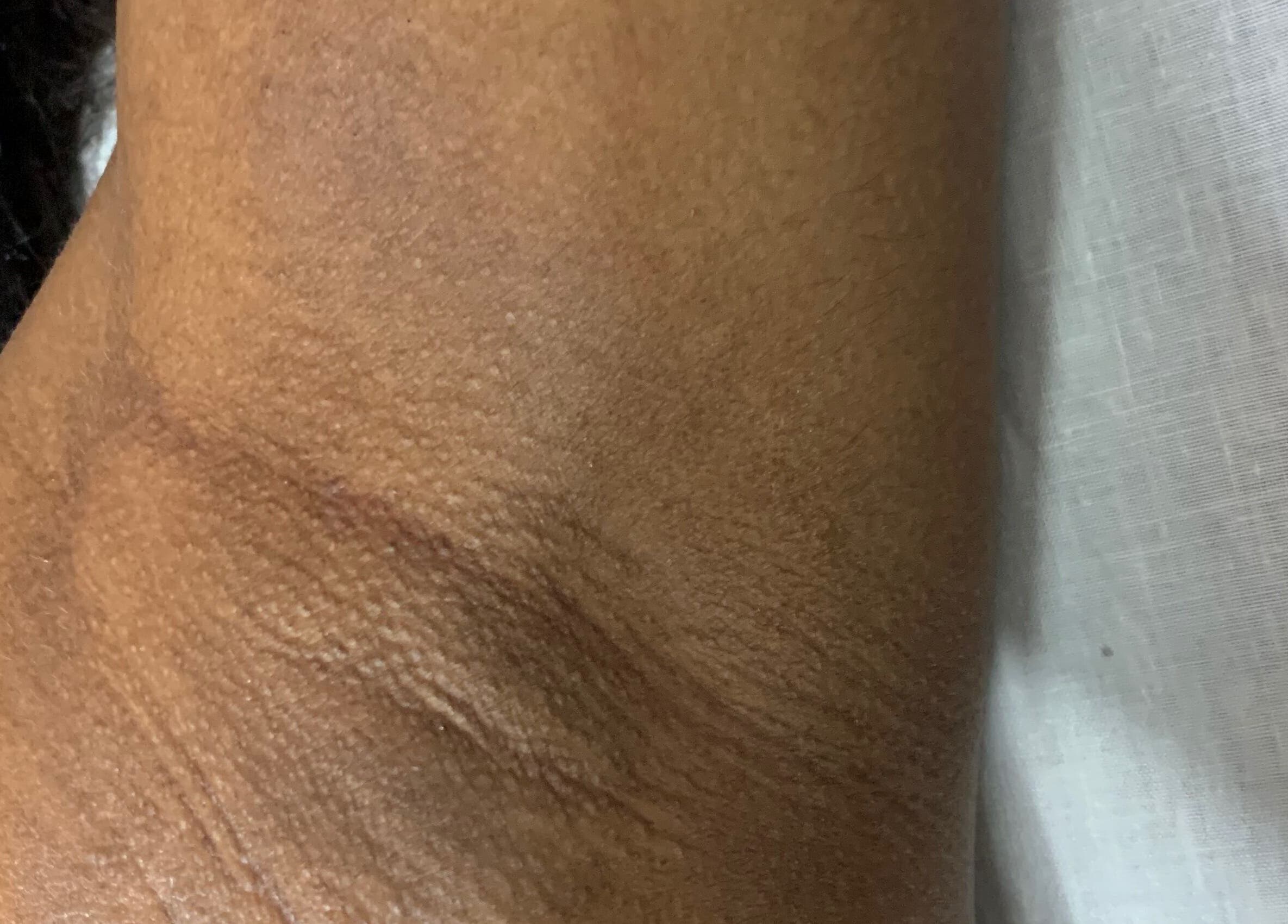 Detail van huidtextuur bij Laiss beauty and cosmetics, Paramaribo, Paramaribo, SR.