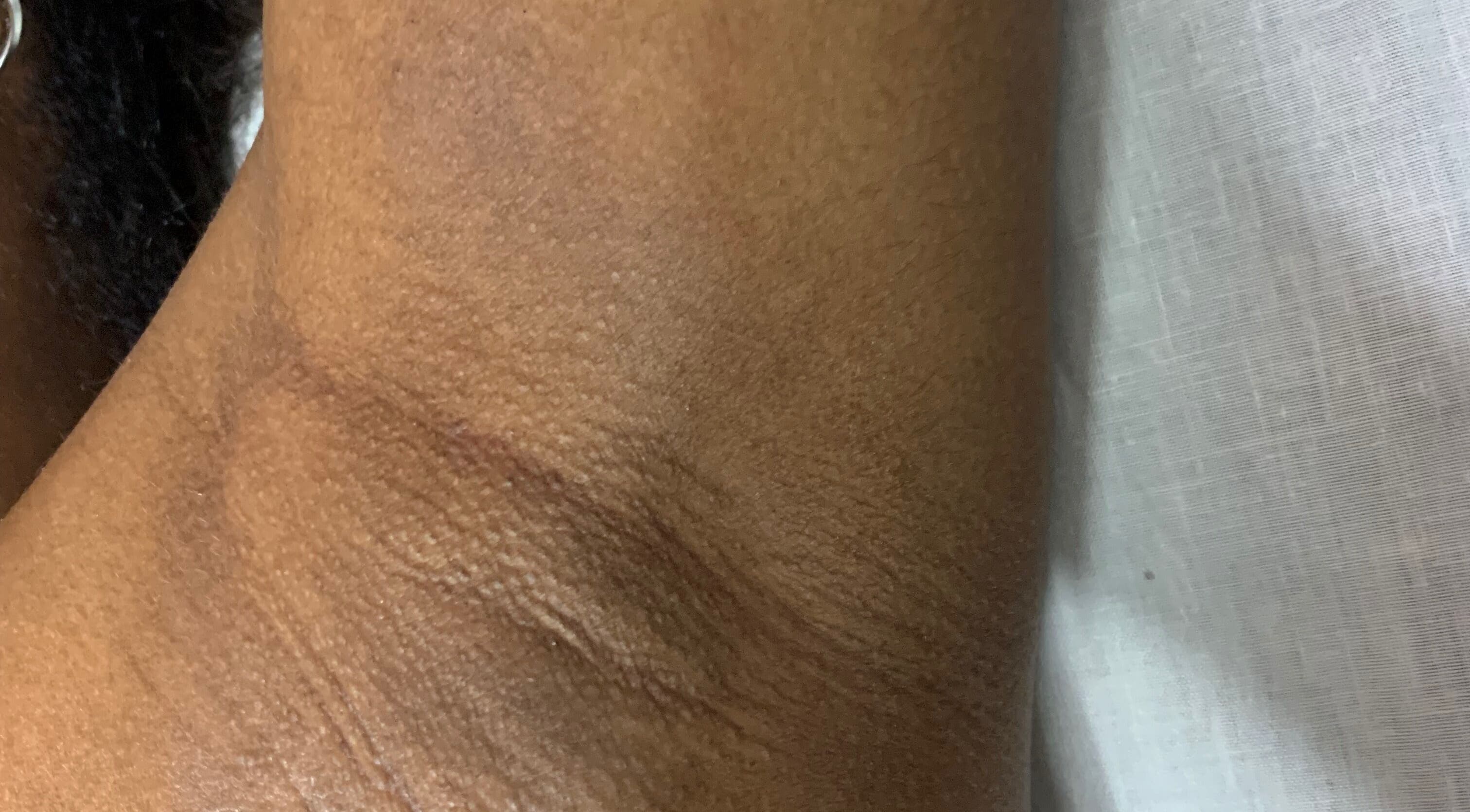 Detail van huidtextuur bij Laiss beauty and cosmetics, Paramaribo, Paramaribo, SR.