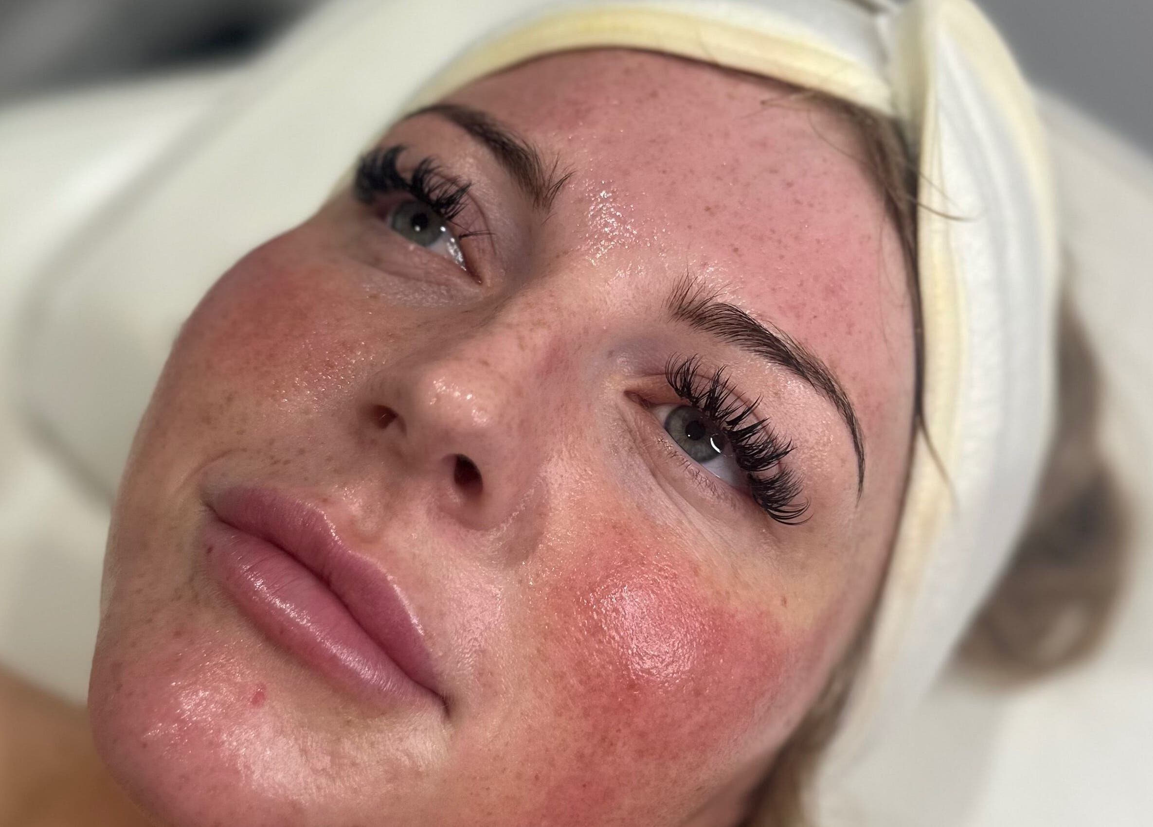 Close-up of a relaxed client's glowing skin after treatment at Pure Radiance by Shauna, Crook, England, GB.