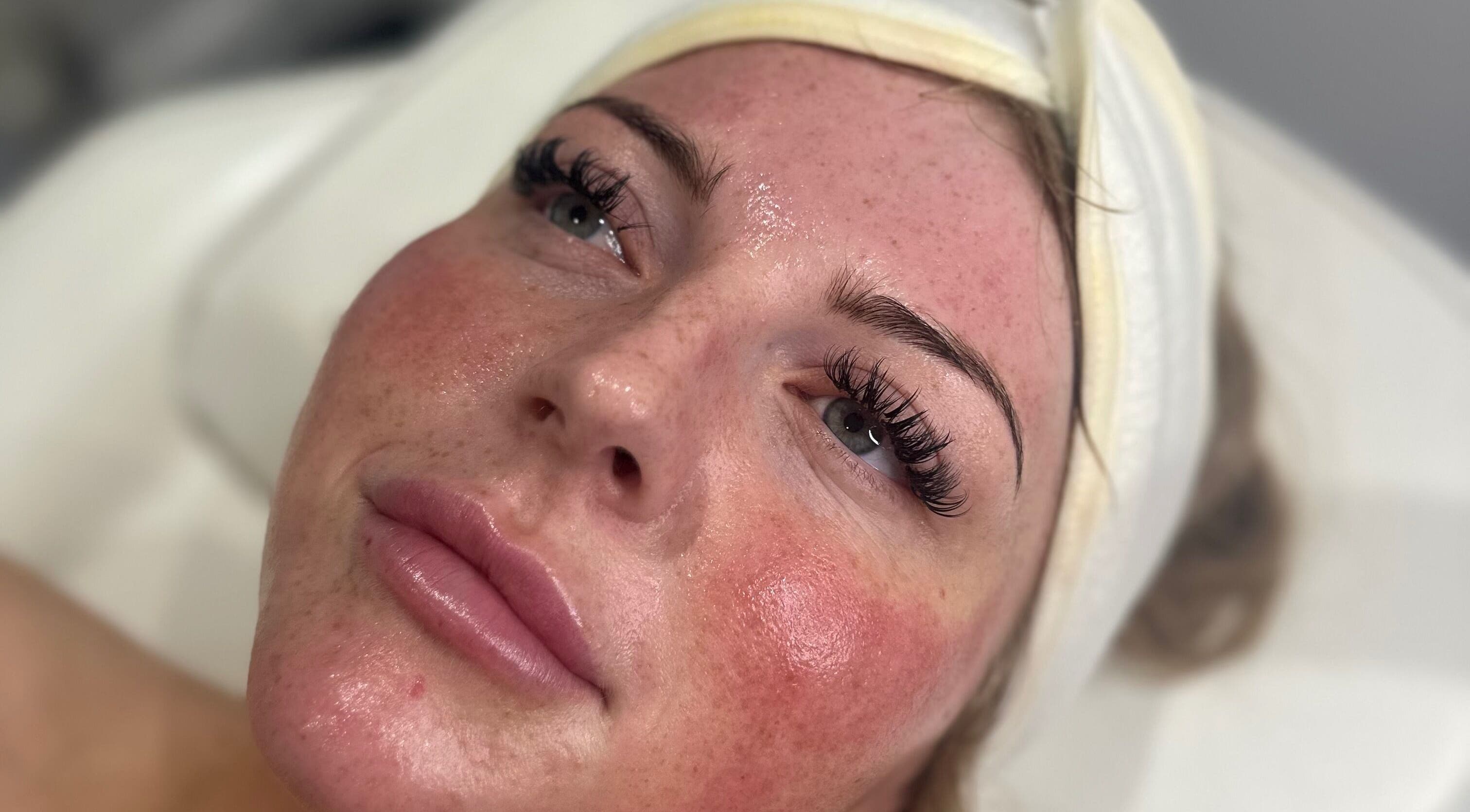 Close-up of a relaxed client's glowing skin after treatment at Pure Radiance by Shauna, Crook, England, GB.