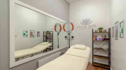 Clear Skin Laser Treatments image 2