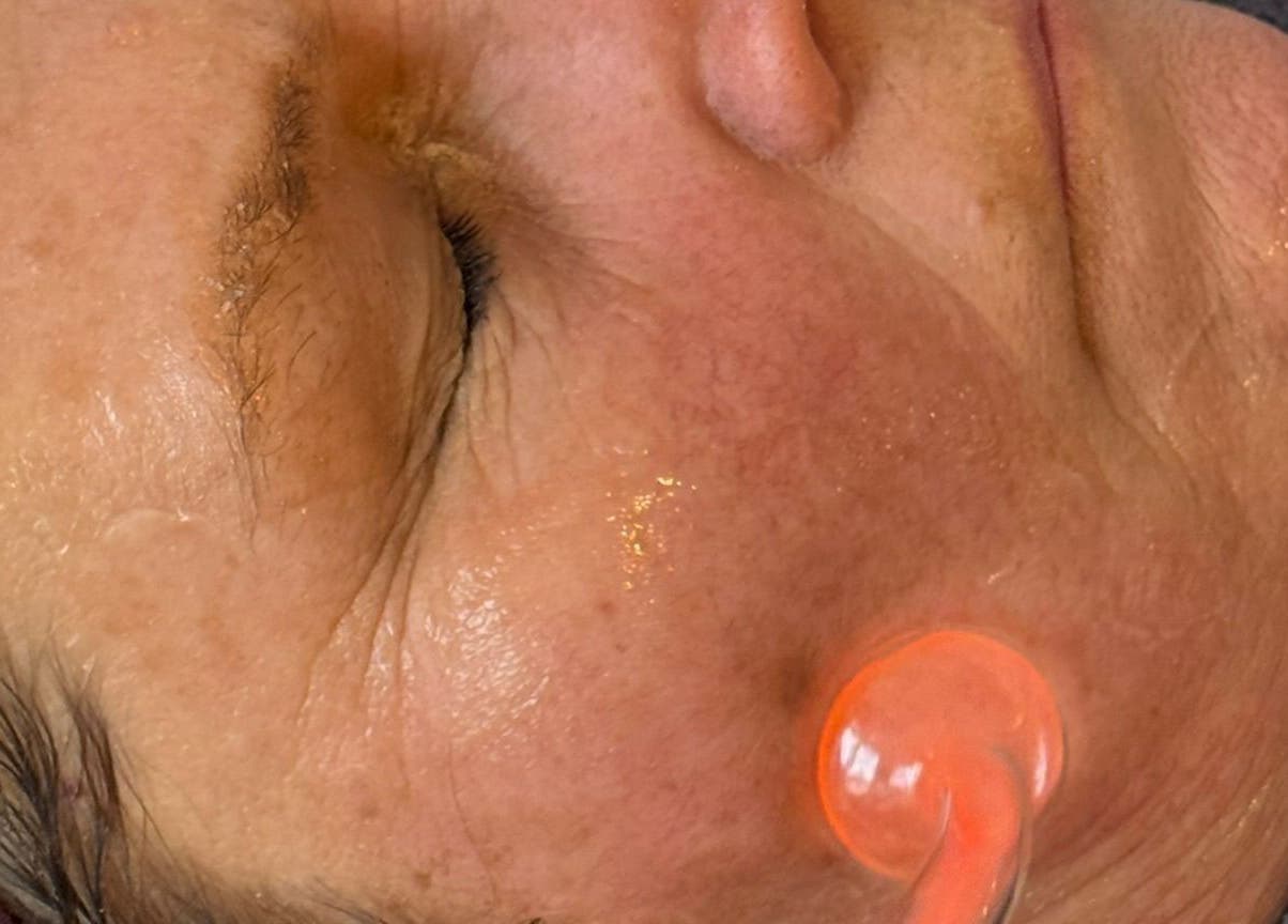 Facial therapy at KF Hair Beauty Lifestyle in Fleetwood, England, GB enhances skin with modern techniques.