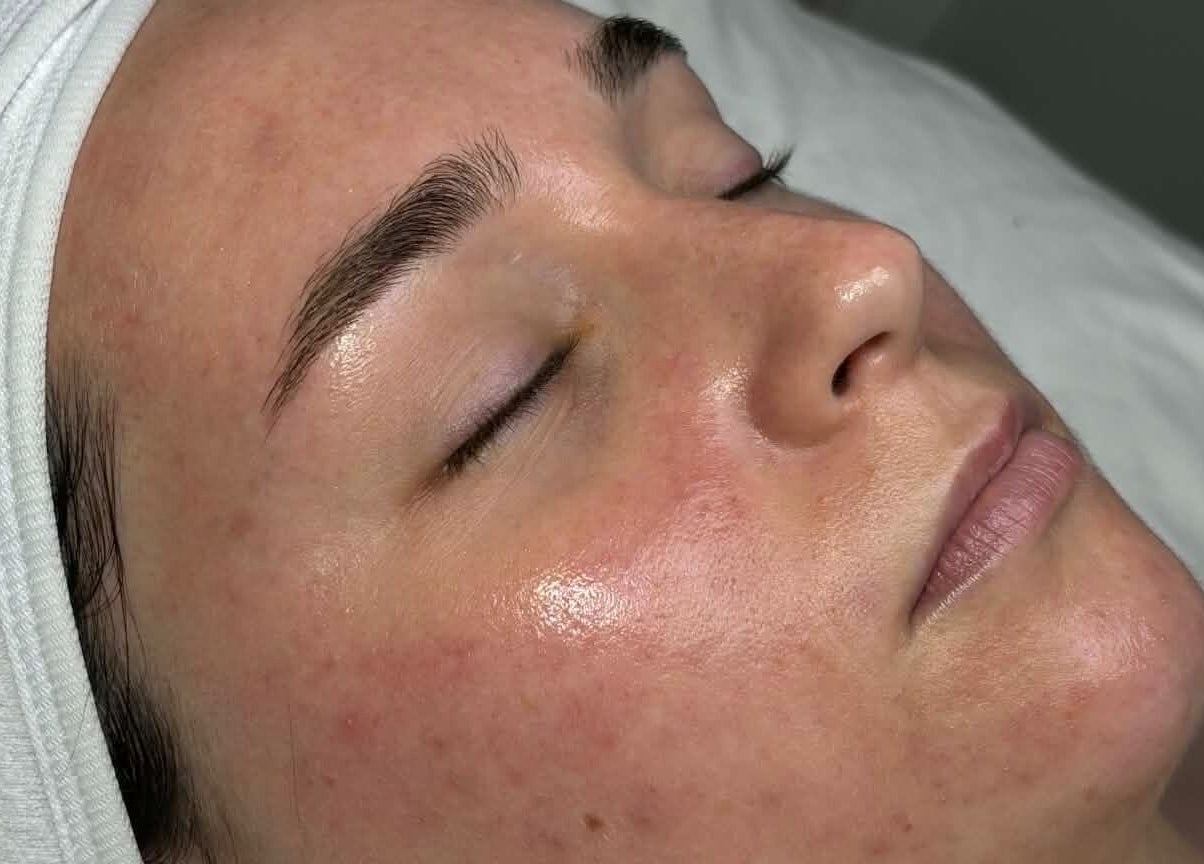 Facial treatment at Carli Esthetics, Cornwall, Ontario, CA, highlighting radiant skin and relaxation.