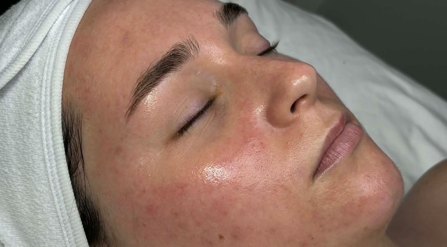 Facial treatment at Carli Esthetics, Cornwall, Ontario, CA, highlighting radiant skin and relaxation.