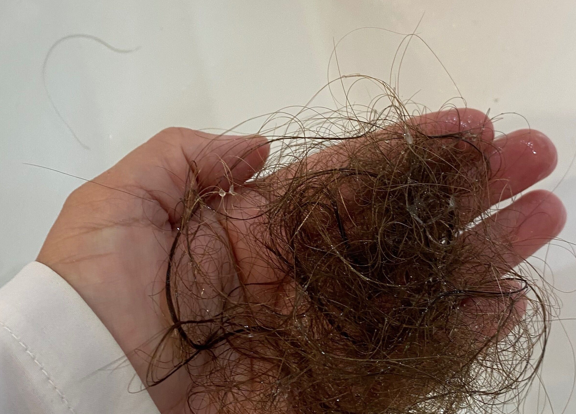 Fios de cabelo em uma mão na Fio Hair Clínica, Portimão, Faro, PT.