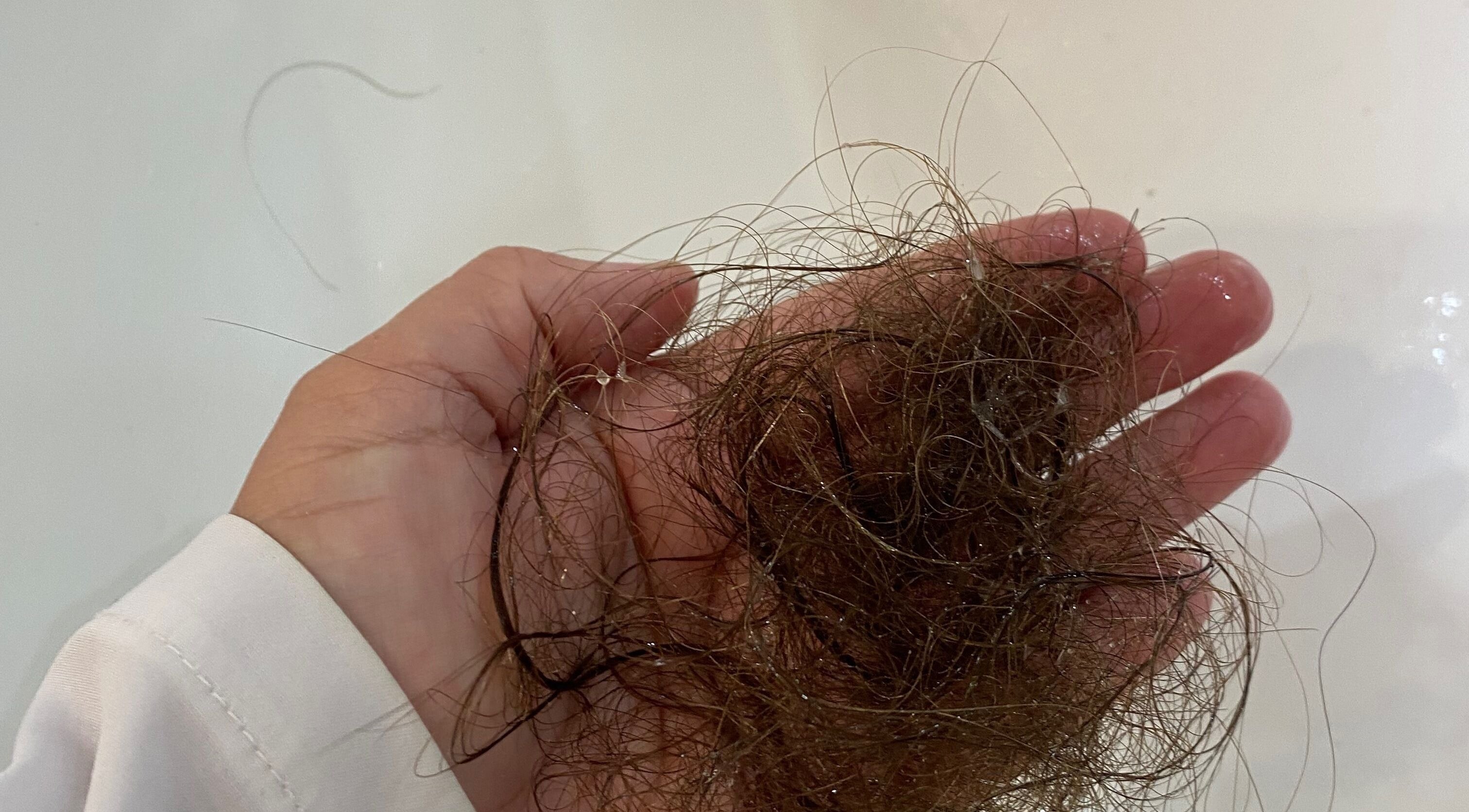 Fios de cabelo em uma mão na Fio Hair Clínica, Portimão, Faro, PT.