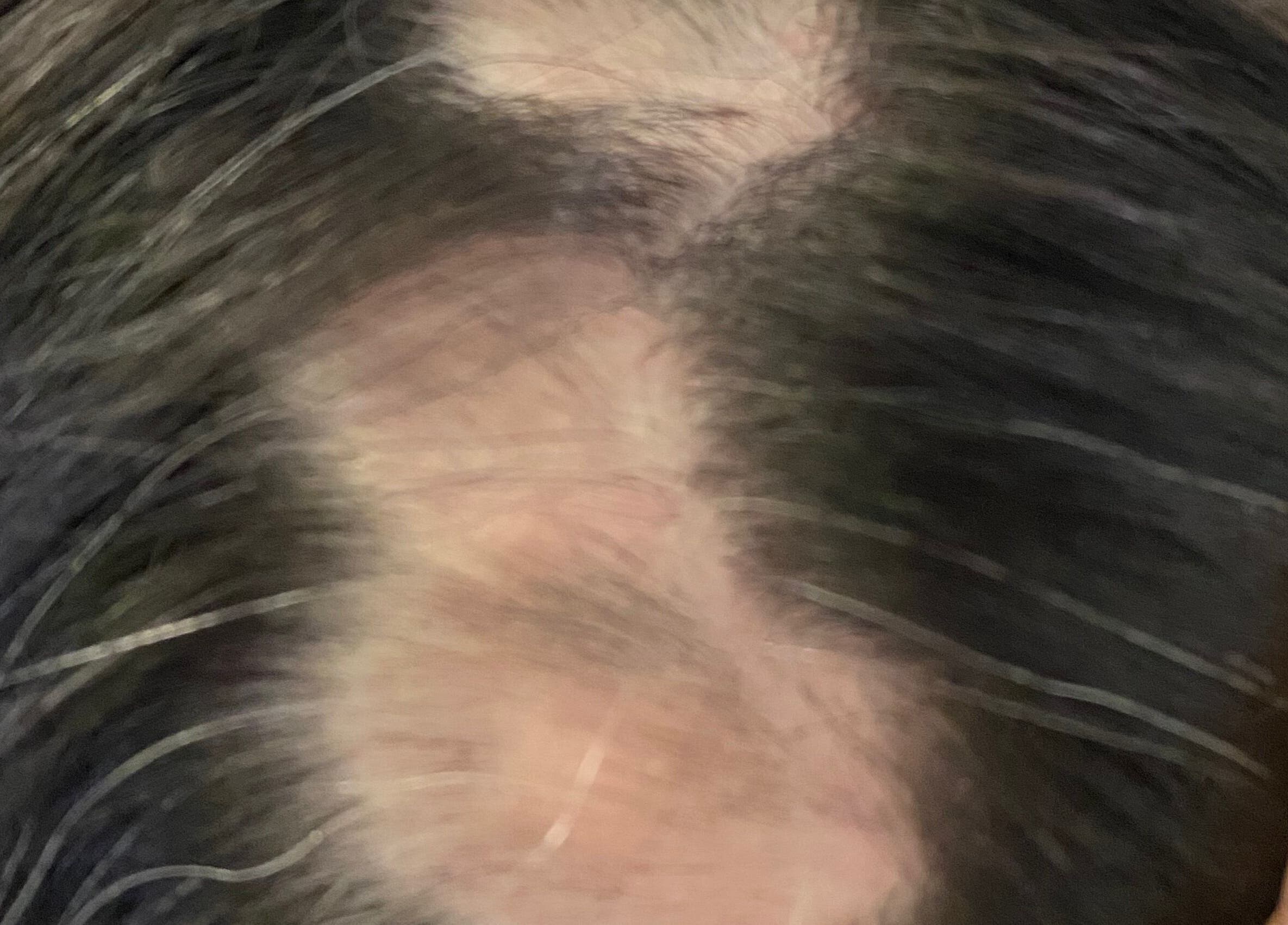 Tratamento capilar na Fio Hair Clínica em Portimão, Faro, PT. Área de couro cabeludo saudável.