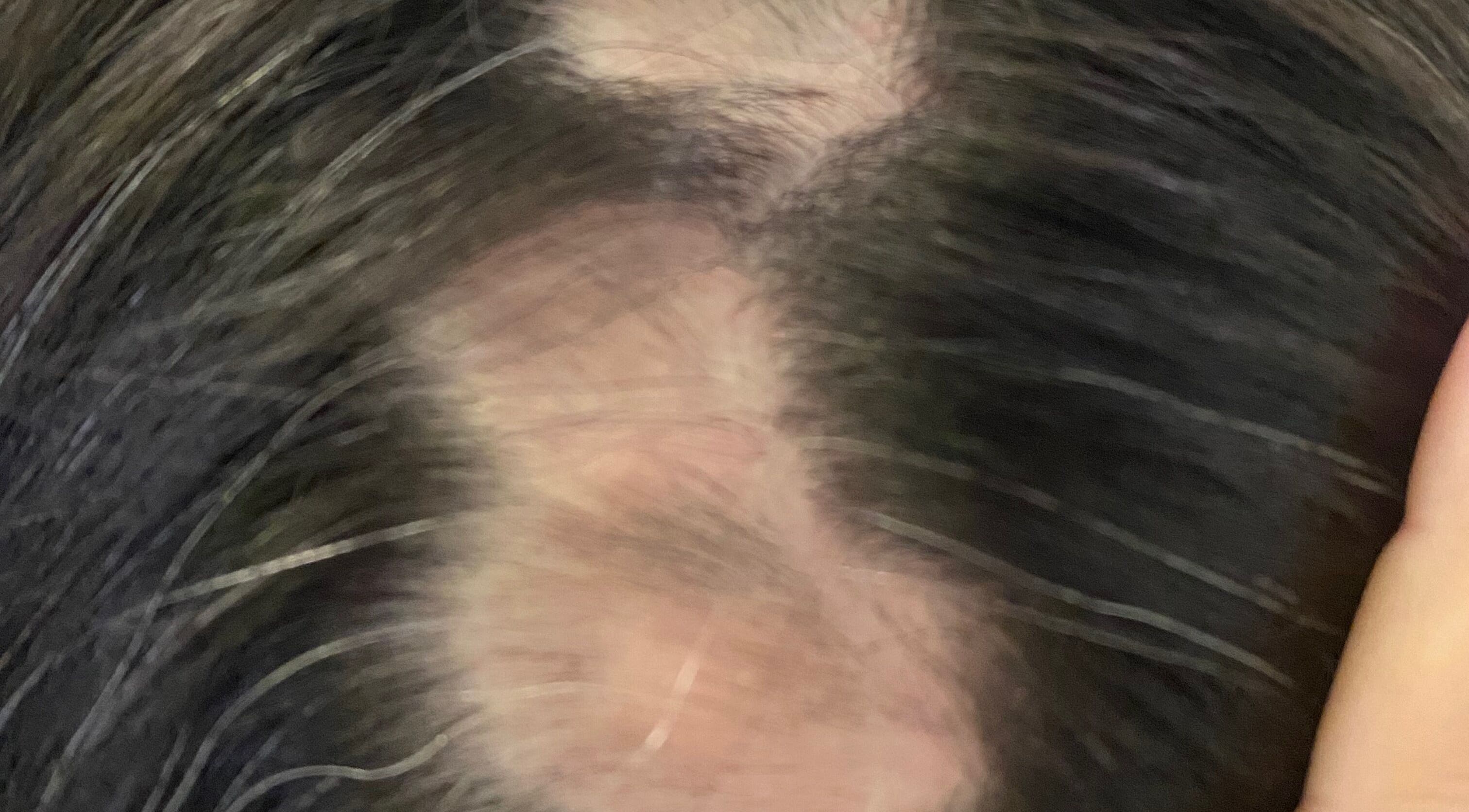 Tratamento capilar na Fio Hair Clínica em Portimão, Faro, PT. Área de couro cabeludo saudável.