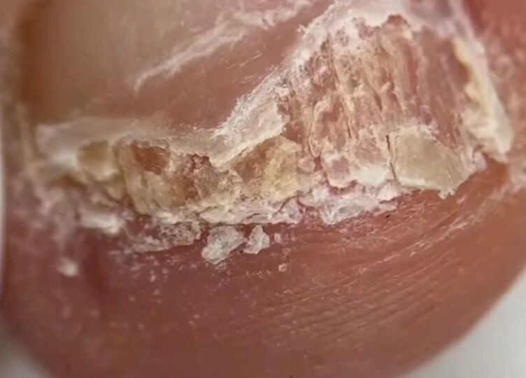 Nail health closeup at Mariam.Podo, Amman, Amman Governorate, JO, highlighting professional nail care.