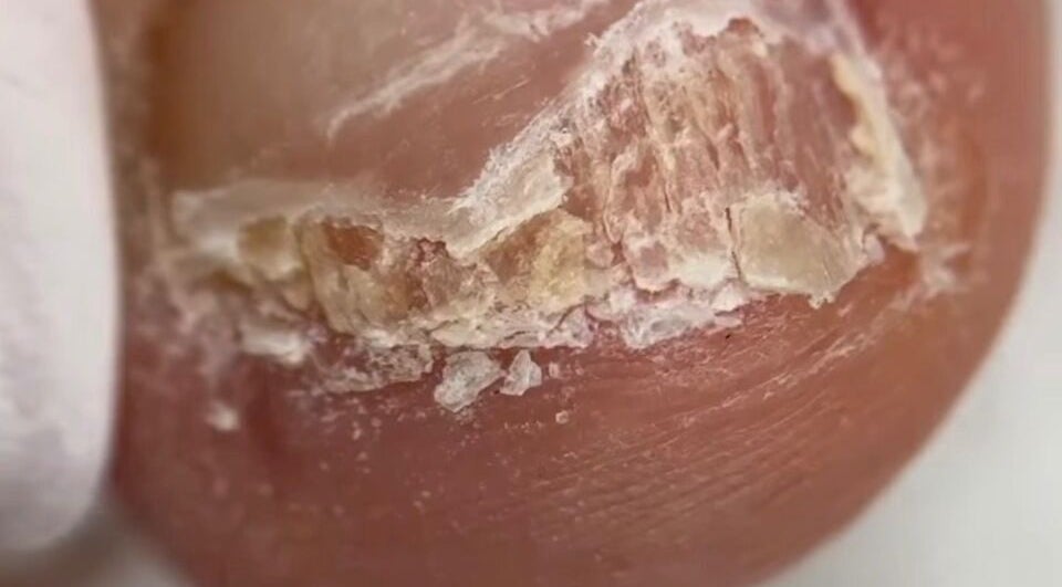 Nail health closeup at Mariam.Podo, Amman, Amman Governorate, JO, highlighting professional nail care.