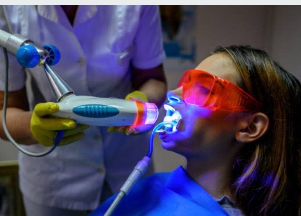 Traitement esthétique dentaire chez Shi’z iconic à Fort-de-France, MQ avec technologie lumineuse.