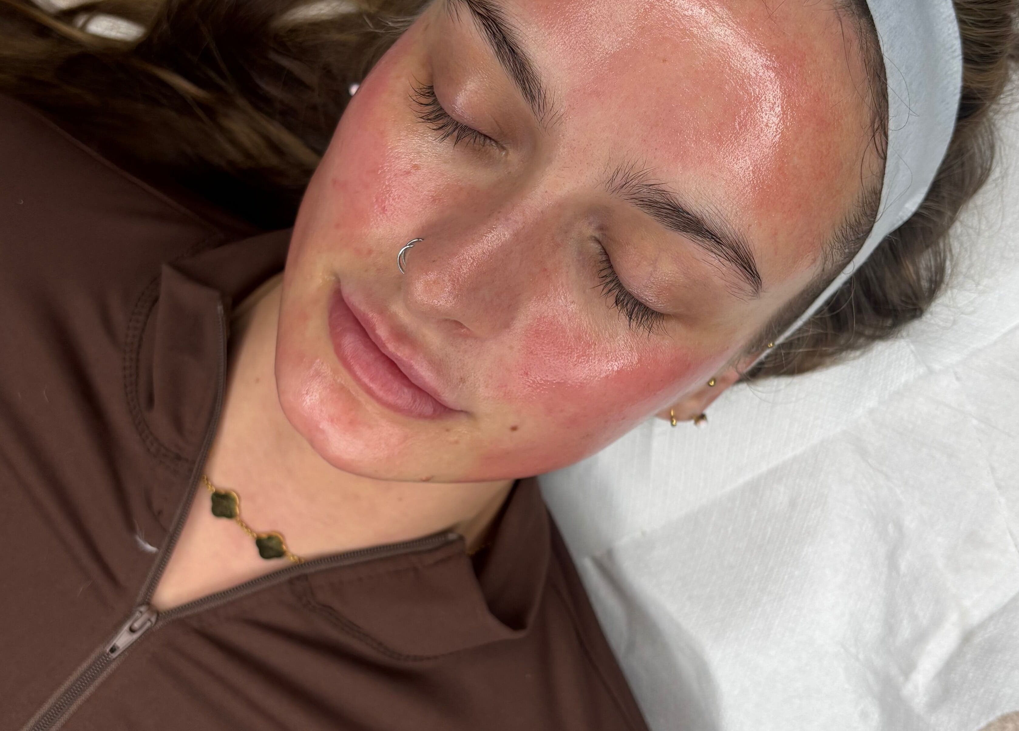 Facial treatment at Skinovation, Midway, England, GB, featuring a relaxed client with glowing skin.