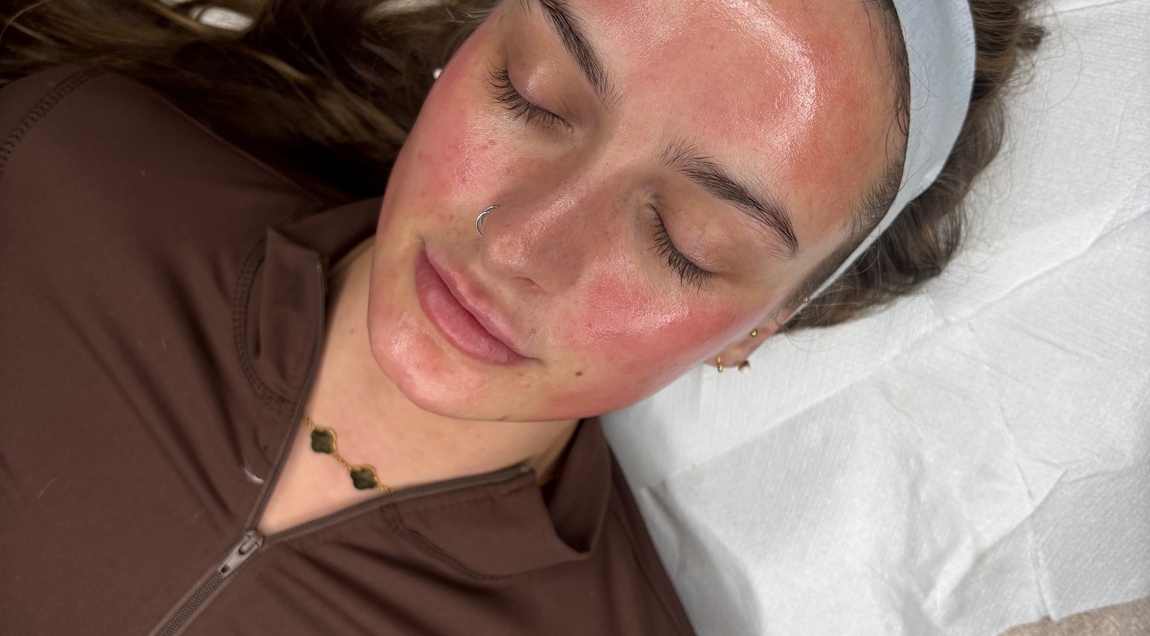 Facial treatment at Skinovation, Midway, England, GB, featuring a relaxed client with glowing skin.