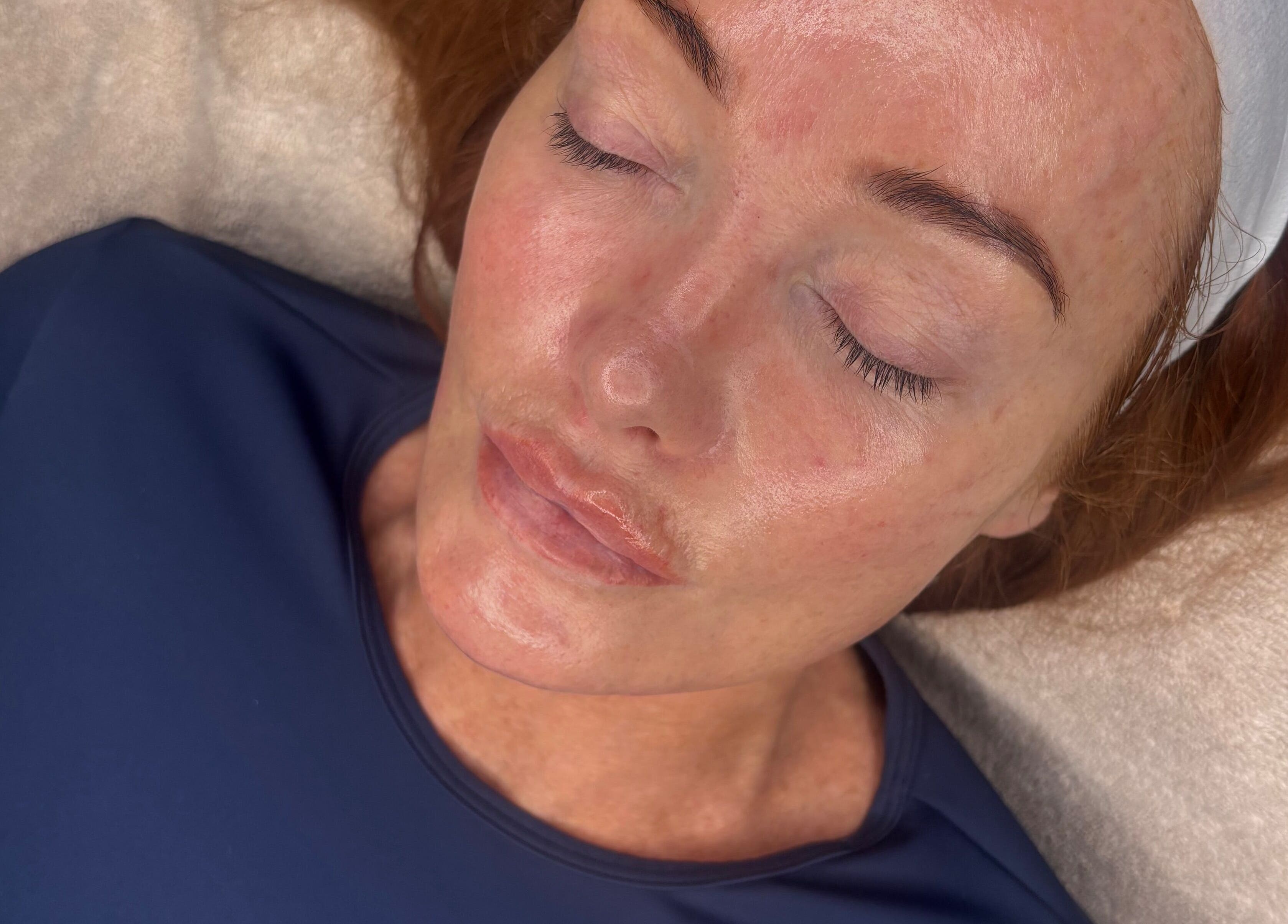 Relaxed client at Skinovation, Midway, England enjoying a calming facial treatment.