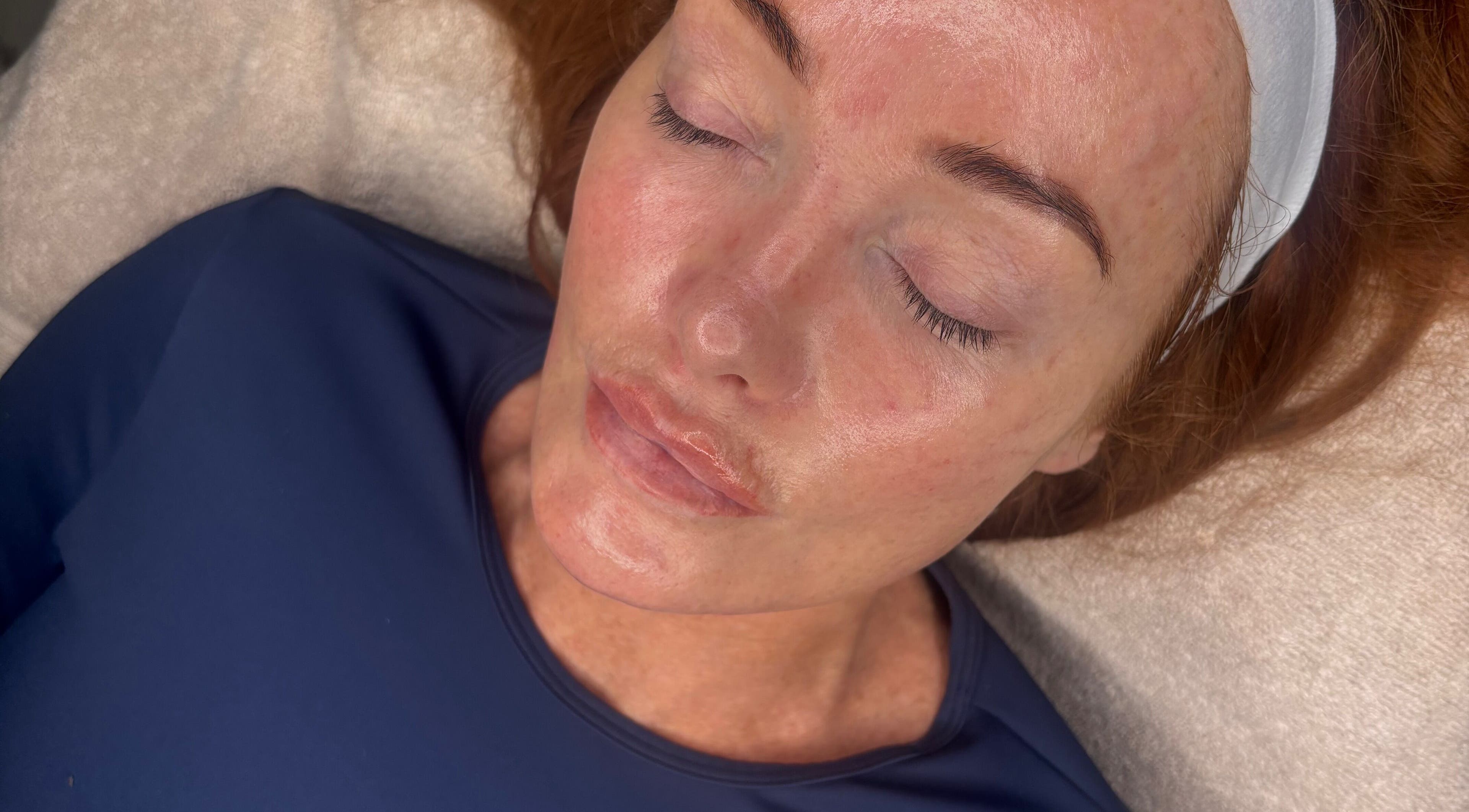 Relaxed client at Skinovation, Midway, England enjoying a calming facial treatment.