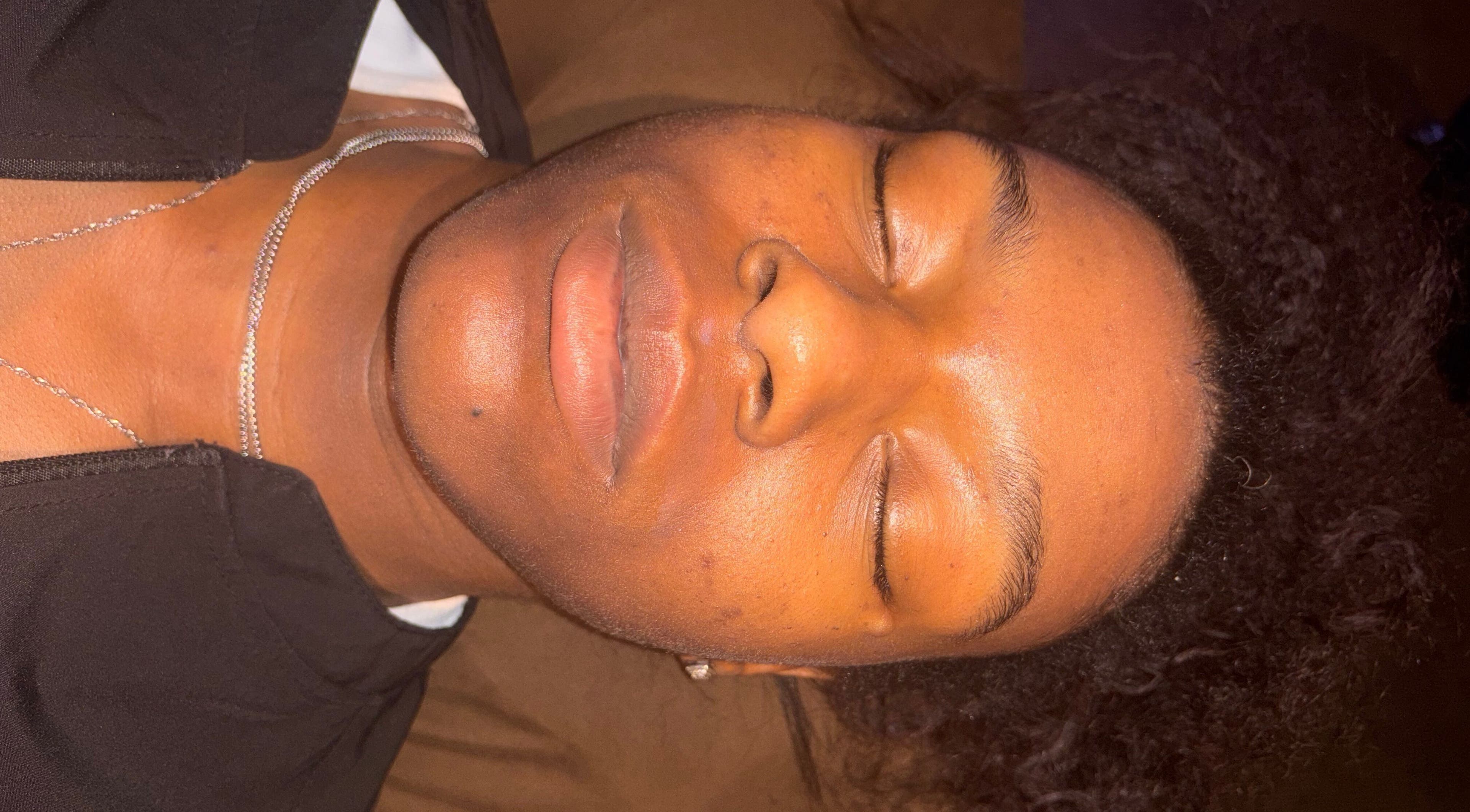 Client receiving facial treatment at iLondon Esthetics, Muskegon, Michigan, US, showcasing relaxed serenity.