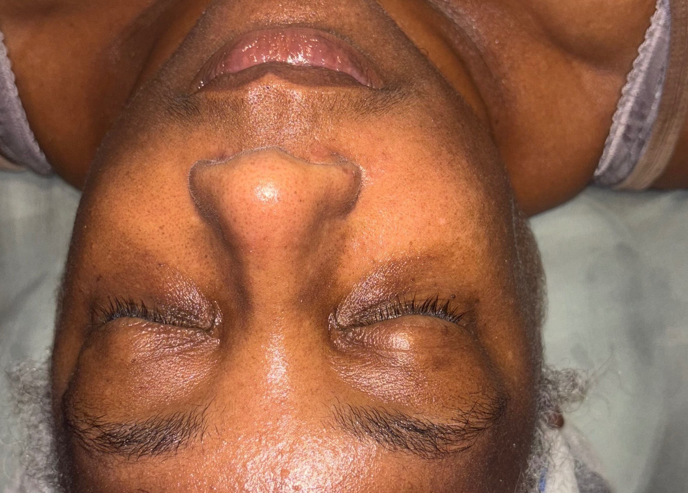 Relaxing facial treatment at iLondon Esthetics in Muskegon, Michigan, US, showcasing a rejuvenation session.