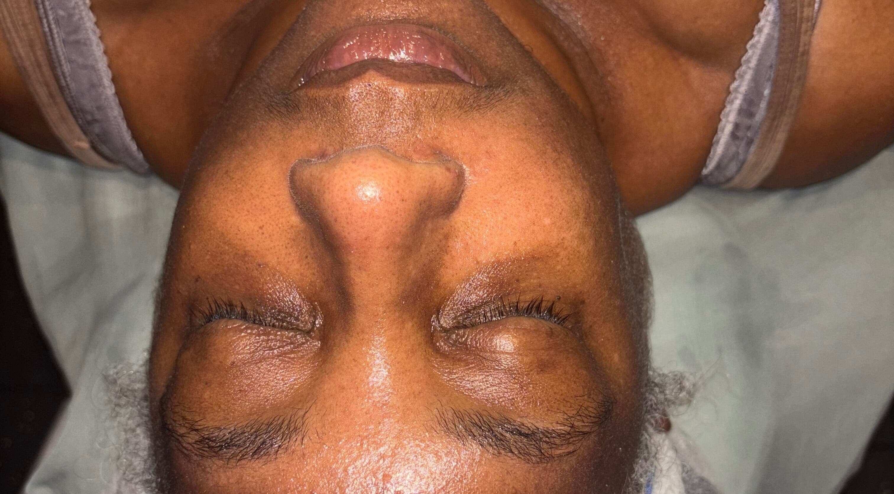 Relaxing facial treatment at iLondon Esthetics in Muskegon, Michigan, US, showcasing a rejuvenation session.