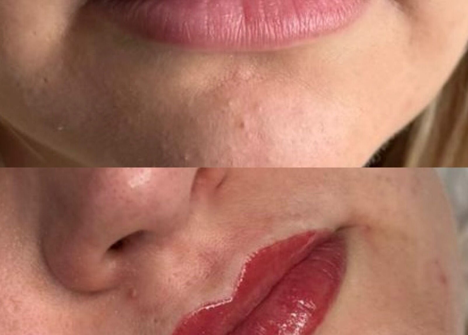 Before and after lip enhancement at Ginnie.Beauty, Liverpool, England, GB. Notice the fuller, glossier lips.